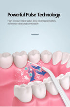 Portable Dental Water Flosser – Rechargeable Oral Irrigator